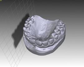 optiscan-3d-eva--eva-lite_2.jpg